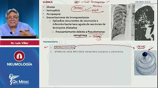 PI24   NEUMOLOGÍA   Bronquiectasias  Tratamiento de complicaciones