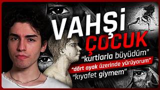 12 Yaşına Kadar ORMANDA Yaşayan "VAHŞİ ÇOCUK" Aveyronlu Victor