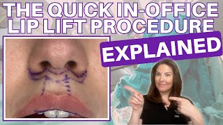 How a Lip Lift Restores Youthful Fullness As You Age