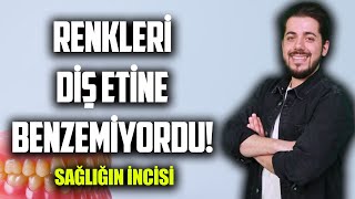 DİŞ PROTEZ TEKNİSYENLERİ NE YAPAR ? 'Diş Protez Teknikeri' Murat KABUL (#sağlığınincisi) #18