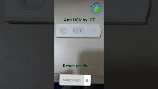 Hepatitis C antibody Test  | HCV Positive | Hepatitis C virus | HCV test | Hepatitis C virus | HCV