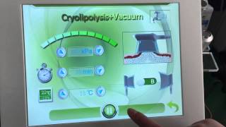 5 in 1 Cryolypolysis screen operation