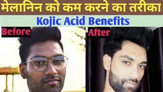 How to decrease melanin in skin | Kojic acid melanin