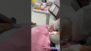 WDC_PERAWATAN SALURAN AKAR GIGI DEPAN | ENDODONTIC TREATMENT #shorts #dentist