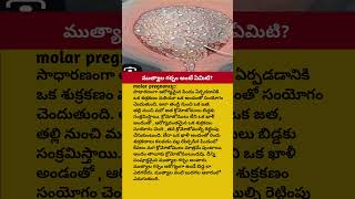 Molar pregnancy | pregnancy care | pregnancy tips telugu | Ammabadi telugu