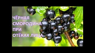 Чёрная СМОРОДИНА регулирует ВОДНО-СОЛЕВОЙ обмен при ОТЁКАХ, отёках ЛИЦА / Фролов Ю.А.