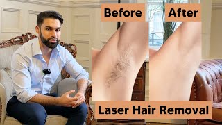 Hair Free with Laser Hair Removal at Hannah London