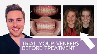 Trialing Your Veneers Before We Start Treatment