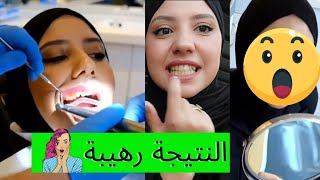 كنت في إستضافة أشهر المستشفيات التجميلية بتركيا😊،قاذيت الحالة شوية😅،شوفو النتيجة🤩،عجبني راسي ياختي😅🤭