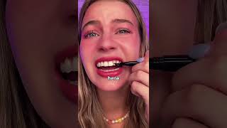 THIS TREND MADE ME LOSE MY TEETH⁉️ *shocking results*