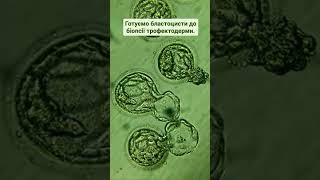 We prepare blastocysts for trophectoderm biopsy.Готуємо бластоцисти до біопсії трофектодерми. #life