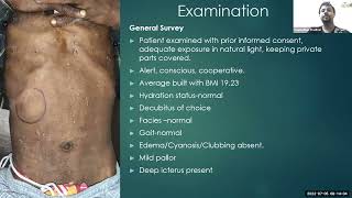 Case Presentation - Obstructive Jaundice: Choledocholithiasis (05.07.22)