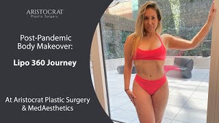 Post-Pandemic Body Makeover: Liposuction 360 Journey