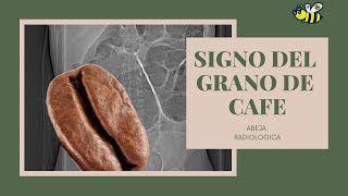 Signo del grano de café