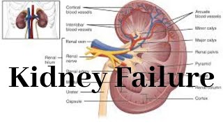 Kidney Failure