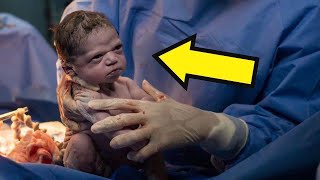 Doctors Advised The Couple Not To Have This Baby, Then Something Unbelievable Happened!