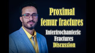 07 Proximal femur: Intertrochanteric fractures (Discussion)