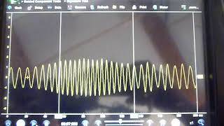 Saab 9-5 crankshaft positions sensor