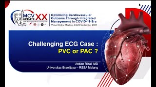 Challenging ECG Case. PVC or PAC ?