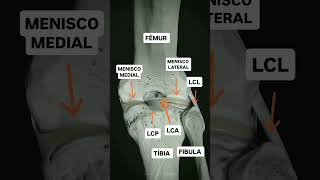 Knee joint anatomy #anatomy #viralreels #physiotherapy #doctor #students #jointpain