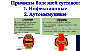 ПРИЧИНЫ болезней СУСТАВОВ и ПОЗВОНОЧНИКА : 1. Инфекционные, 2. Аутоиммунные / Фролов Ю.А.