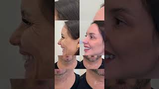 Dra Giovanna Gonzalez transforma Vidas através da harmonização facial.