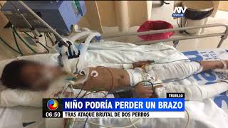 Trujillo: Perros atacaron brutalmente a un niño