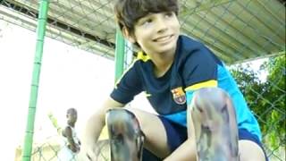 Boy born without any legs, who dribbled Messi, wins new prosthetic legs - Norte Fluminense news