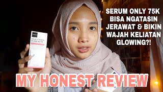 MY HONEST REVIEW SERUM SCARLETT PAKAI SELAMA 2 MINGGU!