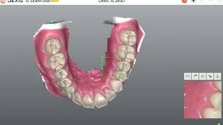 DEXIS™IS ScanFlow | Video 2: Vamos escanear?