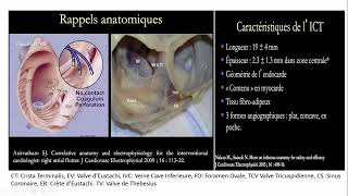 LE Flutter Atrial Commun   Dr  Timnu Bekouti jEAN