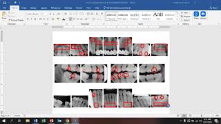 Determining Retakes FMX