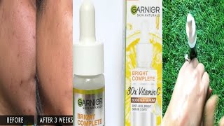 Garnier Vitamin C Serum Review ||Use 30x Vitamin C Booster Serum - YouTube