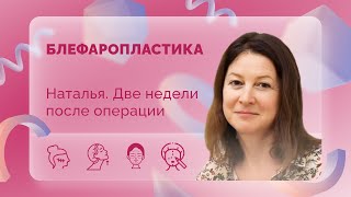 Наталья. Блефаропластика. 14 сутки после операции