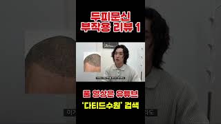 두피문신 부작용 리뷰하기1