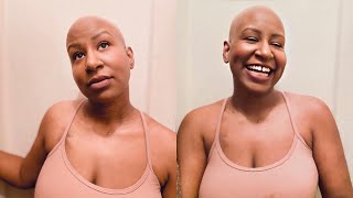 Bald and Beautiful: Daphne’s Story of Resilience and Sisterly Support