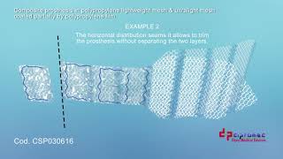 Halbamesh   Mesh for Colposacropexy