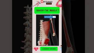 Identify the Muscle of upper limb quiz #anatomy #humananatomy #upperlimuscles