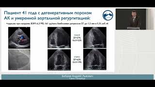 Роль стресс-эхо в определении тяжести клапанной недостаточности и показаний к оперативному лечению