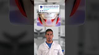 Cómo PREVENIR las FRACTURAS y FISURAS en los DIENTES