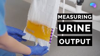 Measuring Urine Output - OSCE Guide | Catheter | UKMLA | CPSA | PLAB 2