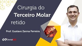 Cirurgia de Terceiro Molar Retido