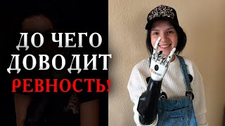 МУЖ ЛИШИЛ ЕЁ ОБЕИХ РУК | РЕАЛЬНАЯ ИСТОРИЯ!