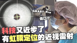 科技又近步了 有虹膜定位的近視雷射 |SMART Pro| 林宜鴻醫師