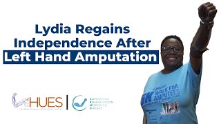 Lydia Regains Independence After Left Hand Amputation