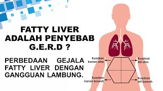 CARA MEMBEDAKAN GEJALA FATTY LIVER DENGAN GANGGUAN LAMBUNG BIASA