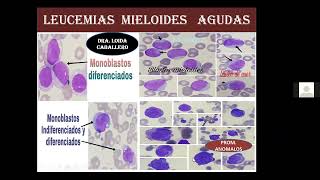 Día 2: Curso actualización en el laboratorio de hematología (24 de febrero 2022)