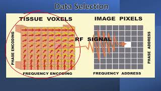 MR Mapping of Tissue