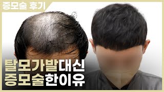 극강난이도 시술했어요. 탈모 가발 대신 두피문신과 헤어증모술로 크롭컷 스타일 선물!!!