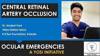 Central Retinal Artery Occlusion | Dr Anujeet Paul | YOSI Ocular Emergency